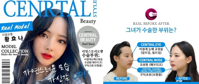 센트럴성형외과